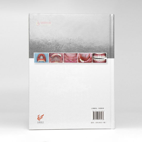 图片 种植覆盖义齿的基础和临床应用